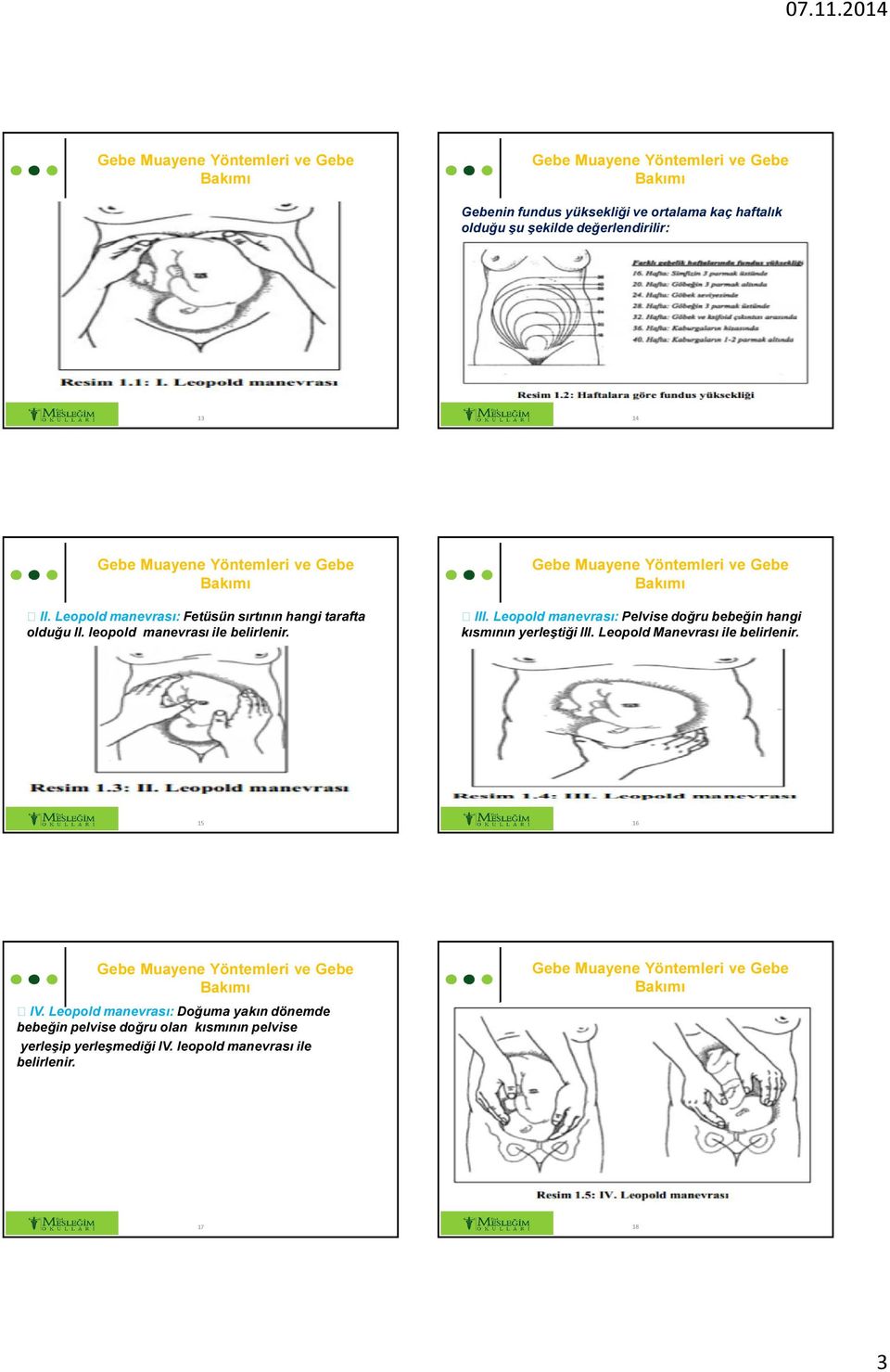Leopold manevrası: Pelvise doğru bebeğin hangi kısmının yerleştiği III. Leopold Manevrası ile belirlenir. 15 16 IV.