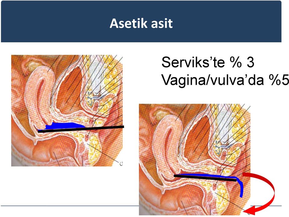 % 3