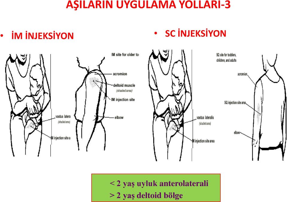 İNJEKSİYON < 2 yaş uyluk