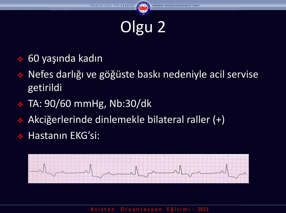 getirildi TA: 90/60 mmhg, Nb:30/dk