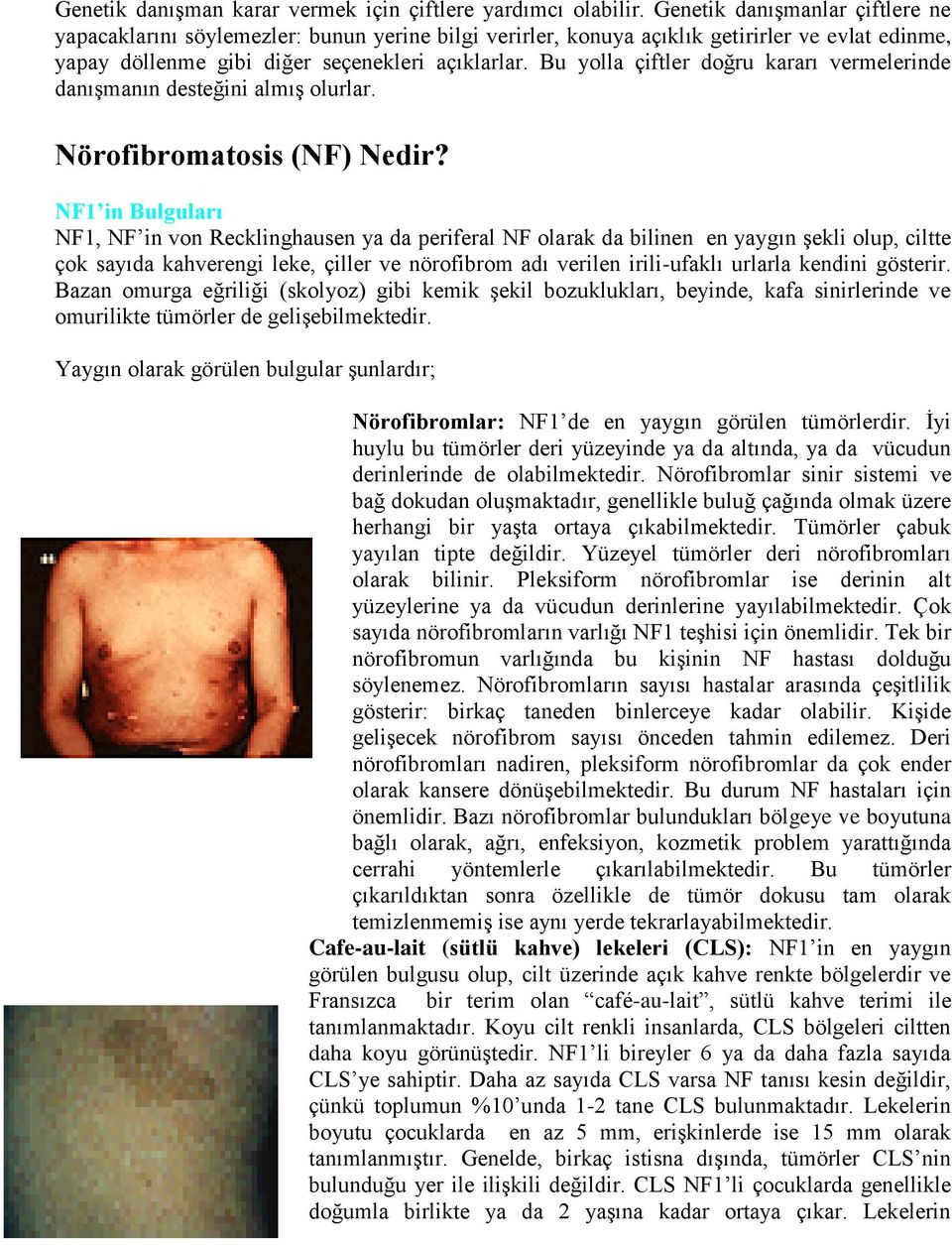 Bu yolla çiftler doğru kararı vermelerinde danışmanın desteğini almış olurlar. Nörofibromatosis (NF) Nedir?