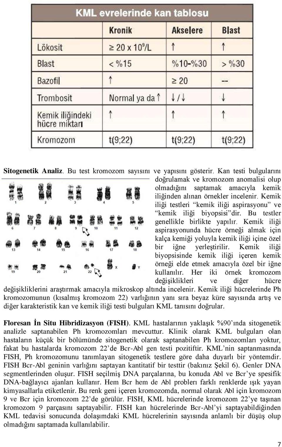 Kemik iliği aspirasyonunda hücre örneği almak için kalça kemiği yoluyla kemik iliği içine özel bir iğne yerleştirilir.