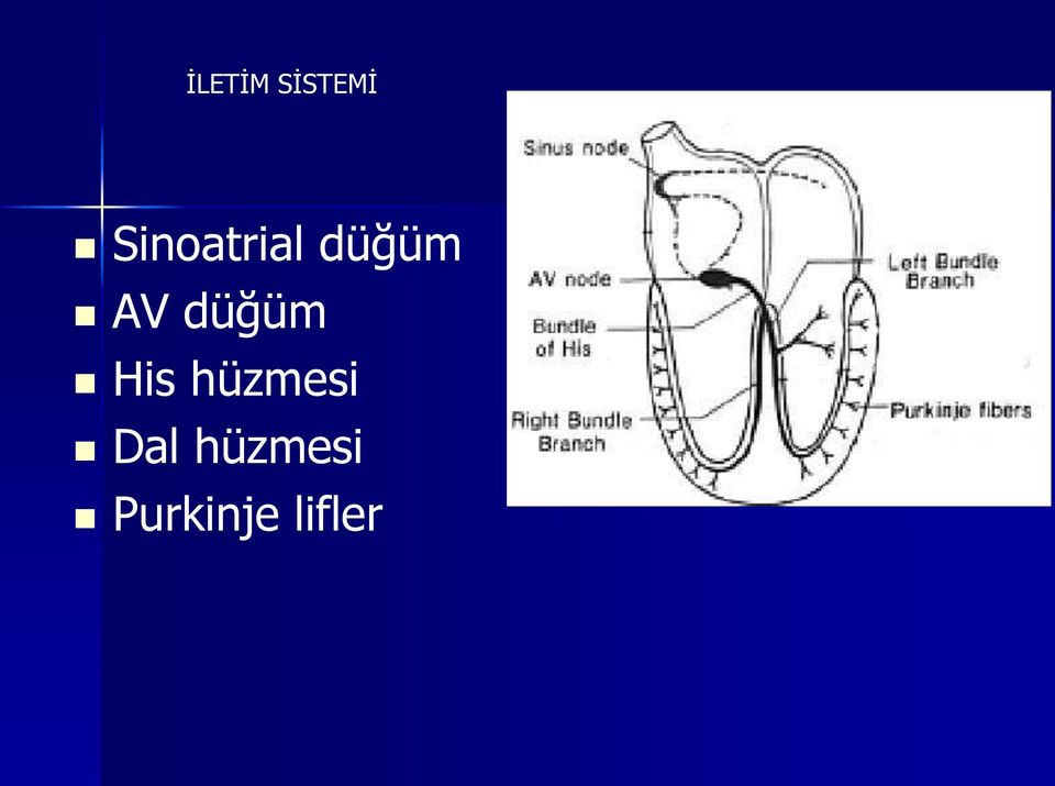 düğüm His hüzmesi