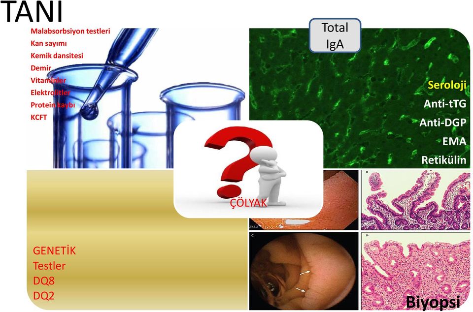 Elektrolitler Anti-tTG Protein kaybı KCFT