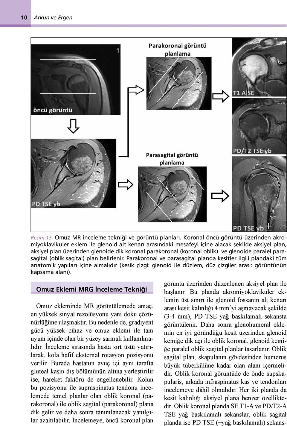 oblik) ve glenoide paralel parasagital (oblik sagital) plan belirlenir.