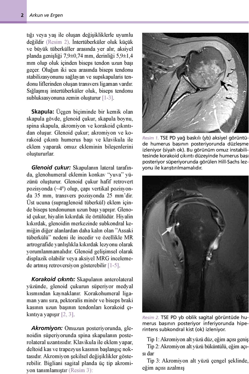 Oluğun iki ucu arasında biseps tendonu stabilizasyonunu sağlayan ve supskapularis tendonu liflerinden oluşan transvers ligaman vardır.