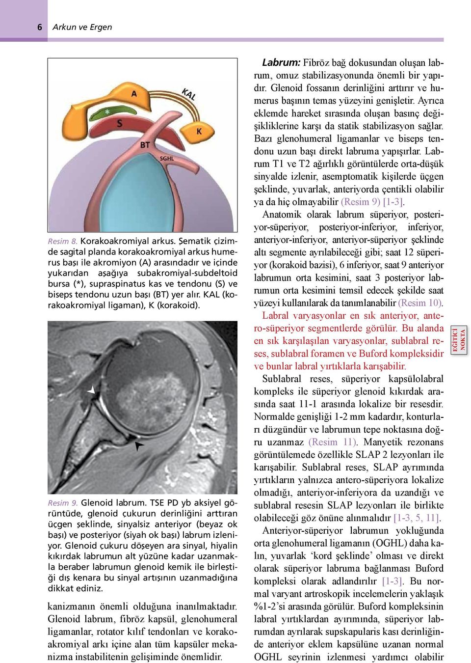 biseps tendonu uzun başı (BT) yer alır. KAL (korakoakromiyal ligaman), K (korakoid). Resim 9. Glenoid labrum.