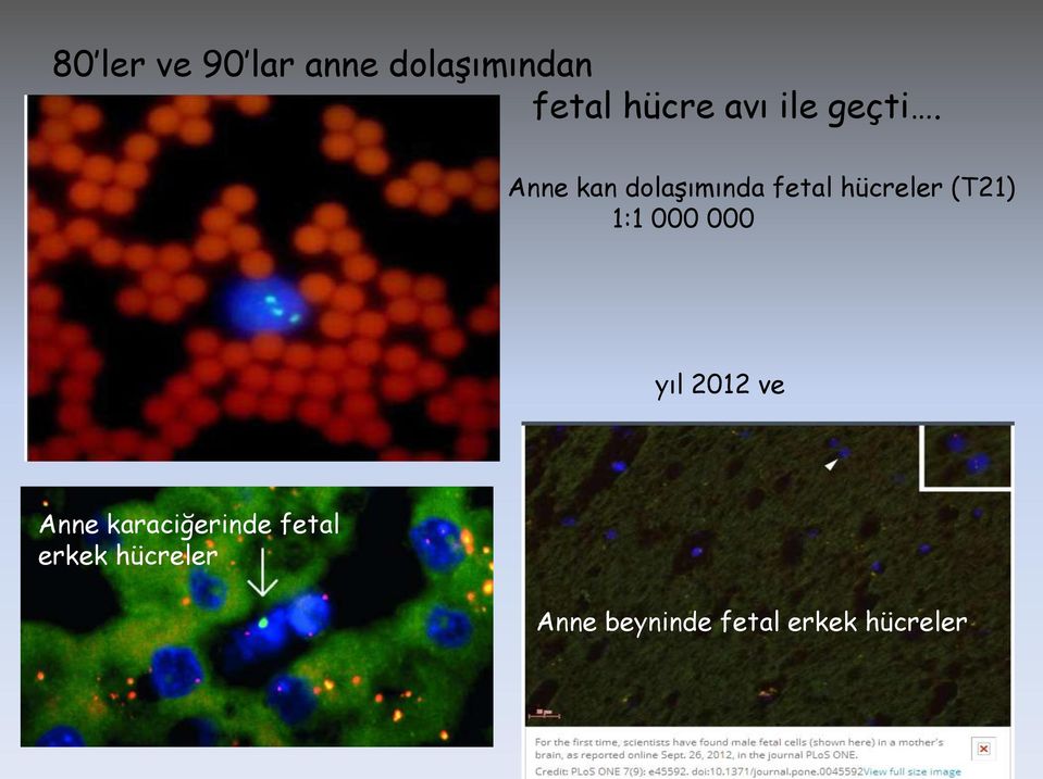 Anne kan dolaşımında fetal hücreler (T21) 1:1 000