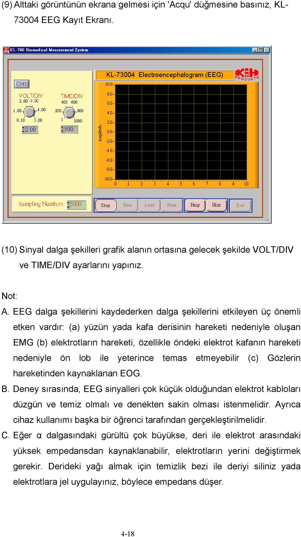 EEG dalga şekillerini kaydederken dalga şekillerini etkileyen üç önemli etken vardır: (a) yüzün yada kafa derisinin hareketi nedeniyle oluşan EMG (b) elektrotların hareketi, özellikle öndeki elektrot