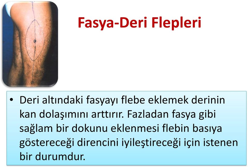 Fazladan fasya gibi sağlam bir dokunu eklenmesi