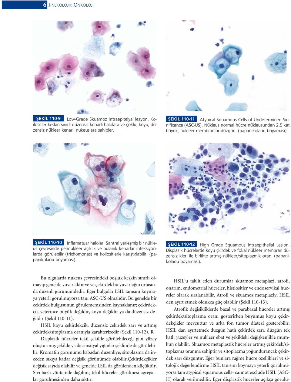 (papanikolaou boyamas ) fiek L 110-10 Inflamatuar halolar.