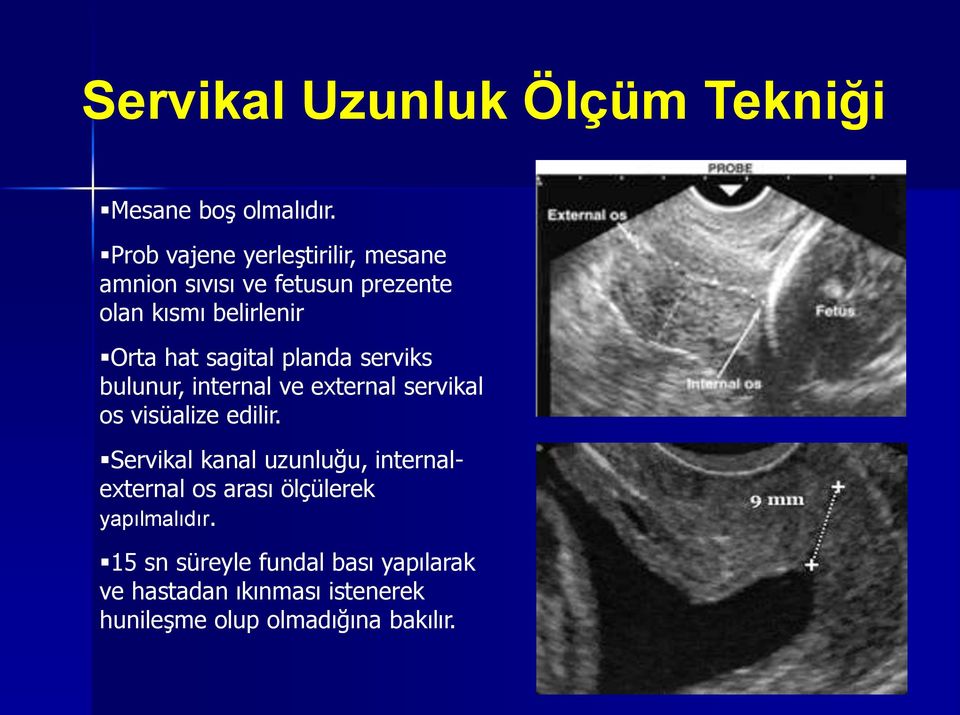 sagital planda serviks bulunur, internal ve external servikal os visüalize edilir.