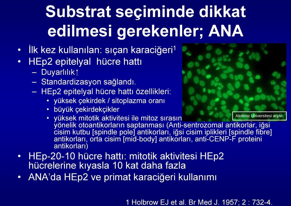 otoantikorların saptanması (Anti-sentrozomal antikorlar, iğsi cisim kutbu [spindle pole] antikorları, iğsi cisim iplikleri [spindle fibre] antikorları, orta cisim [mid-body] antikorları,