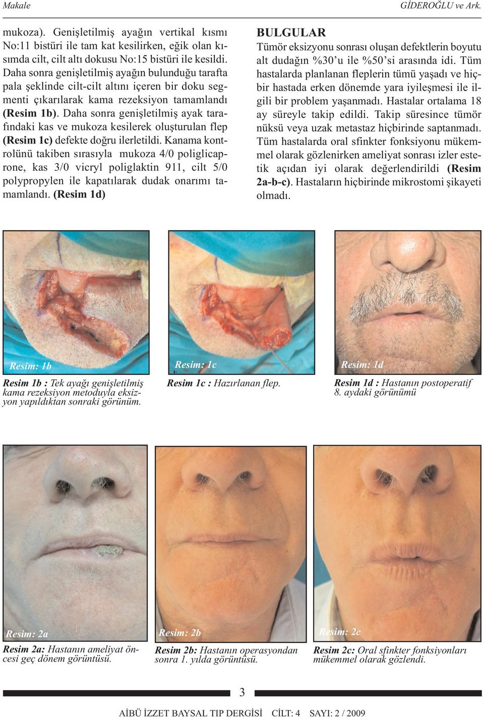 11. Nakajima T, Yoshimura Y, Kami T. Reconstruction of the lower lip with a fan-shaped flap based on the facial artery. Br J Plast Surg. 1984, 37:52-4. 12. McGregor IA.