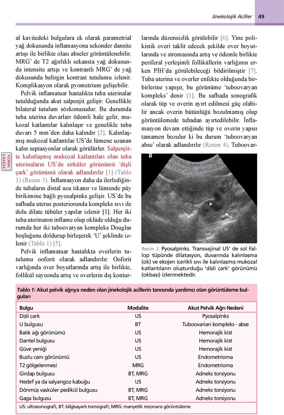 Pelvik inflamatuar hastalıkta tuba uterinalar tutulduğunda akut salpenjit gelişir. Genellikle bilateral tutulum sözkonusudur.