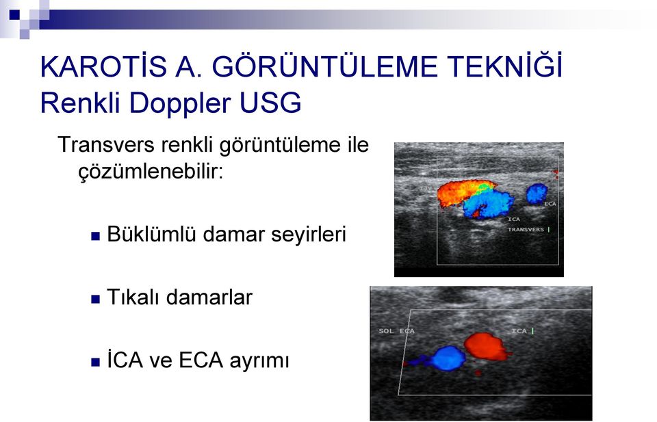 Transvers renkli görüntüleme ile