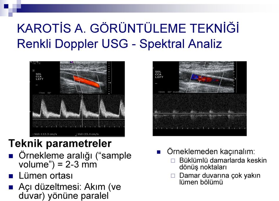 parametreler Örnekleme aralığı ( sample volume ) = 2-3 mm Lümen ortası Açı