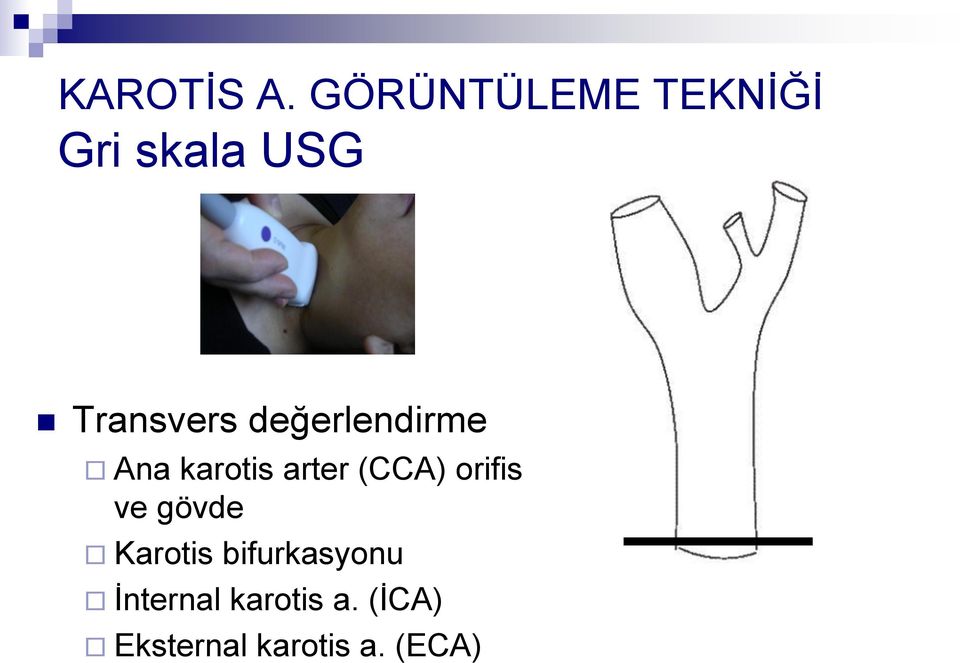 değerlendirme Ana karotis arter (CCA) orifis