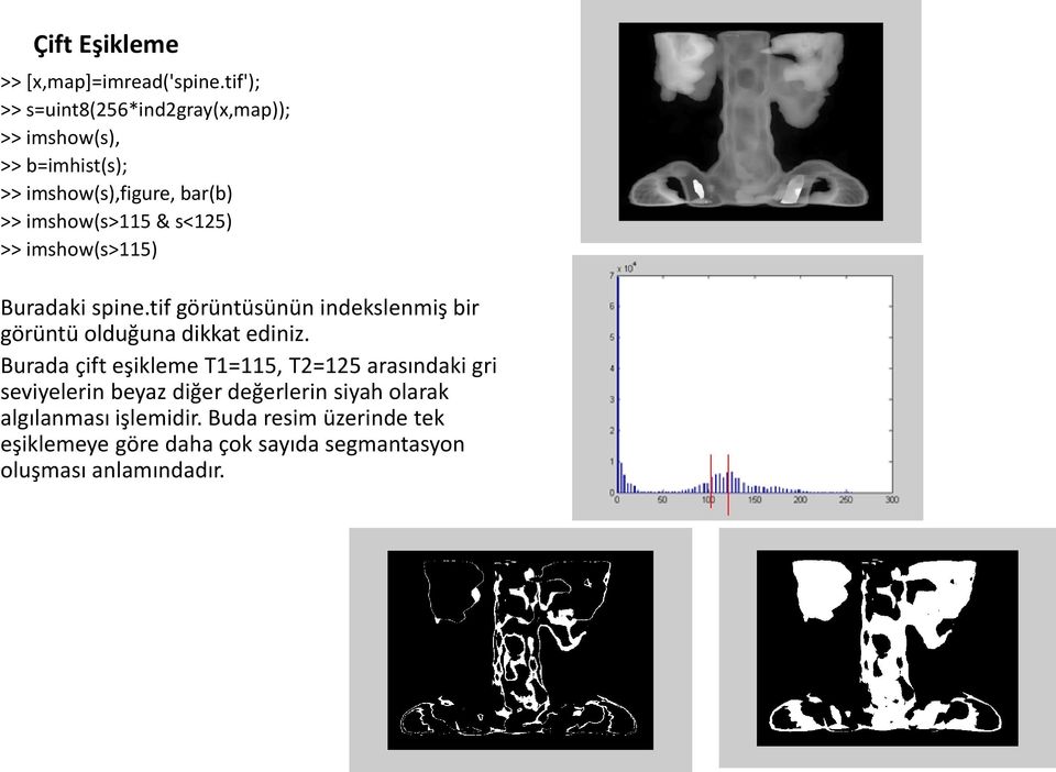 s<125) >> imshow(s>115) Buradaki spine.tif görüntüsünün indekslenmiş bir görüntü olduğuna dikkat ediniz.