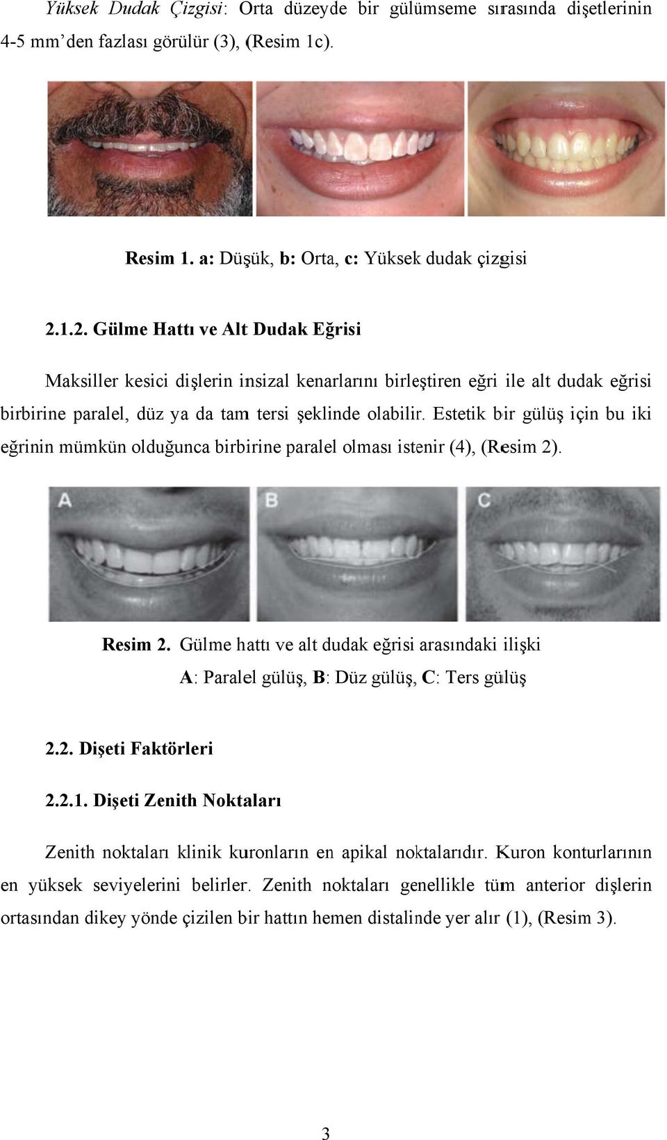 Estetik bir gülüş için bu iki eğrinin mümkün olduğunca birbirine paralel olması istenir (4), (Resim 2). Resim 2.