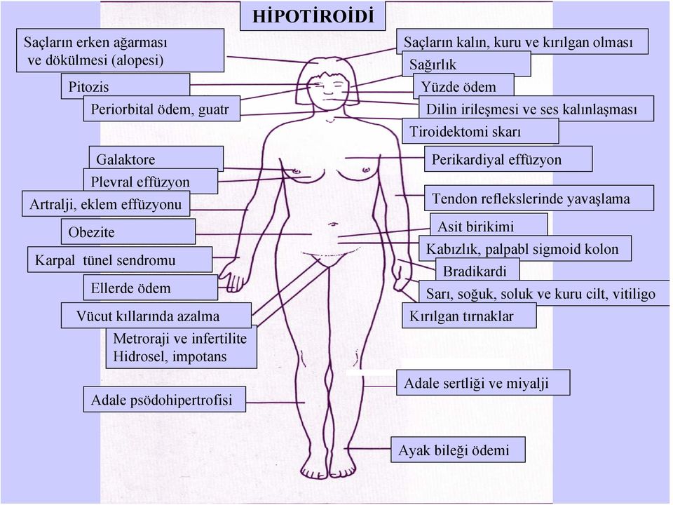 kırılgan olması Sağırlık Yüzde ödem Dilin irileşmesi ve ses kalınlaşması Tiroidektomi skarı Perikardiyal effüzyon Tendon reflekslerinde yavaşlama Asit