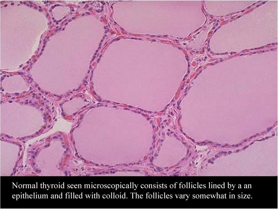 epithelium and filled with colloid.