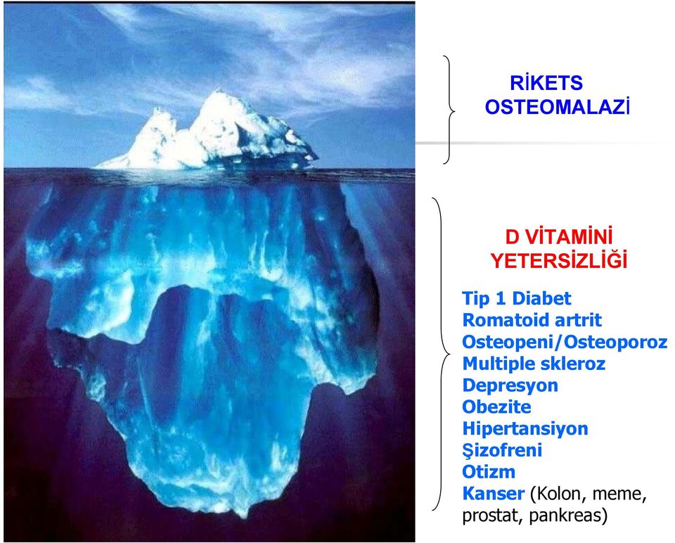 Multiple skleroz Depresyon Obezite Hipertansiyon