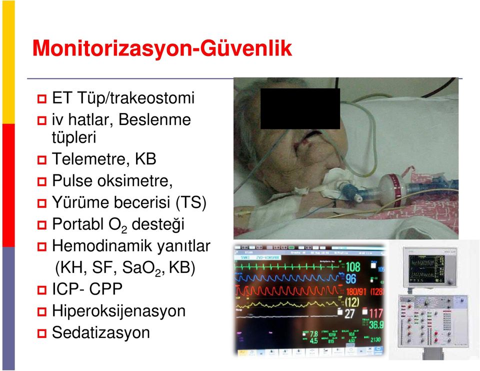 becerisi (TS) Portabl O 2 desteği Hemodinamik yanıtlar