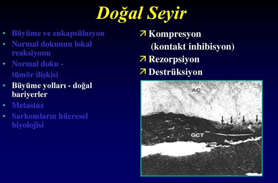 doğal bariyerler Metastaz Sarkomların hücresel