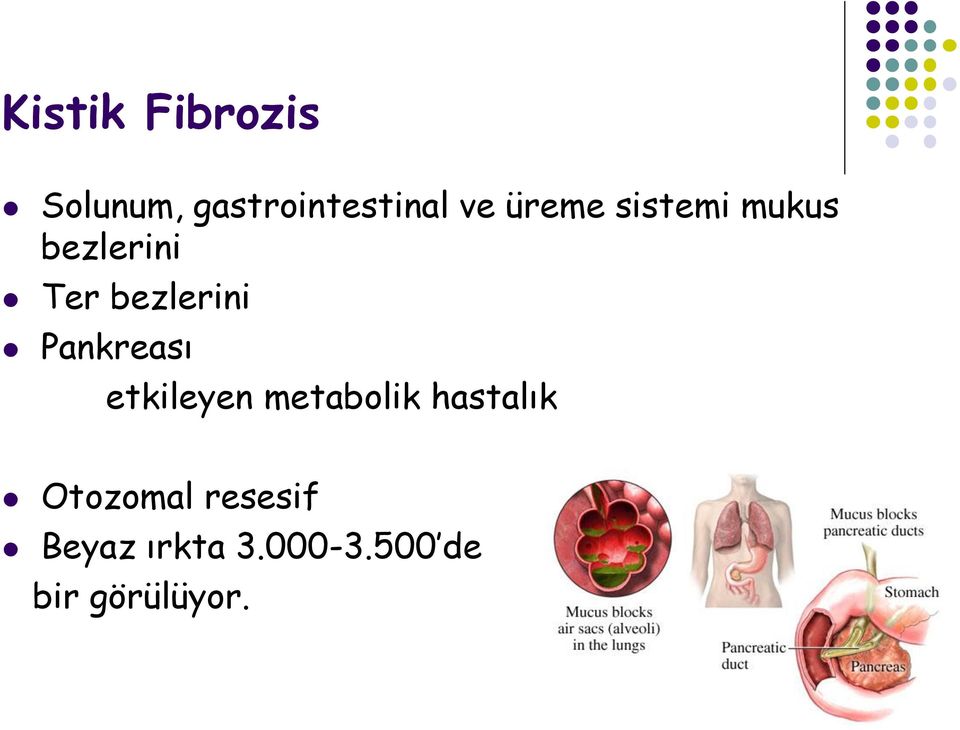 Pankreası etkileyen metabolik hastalık