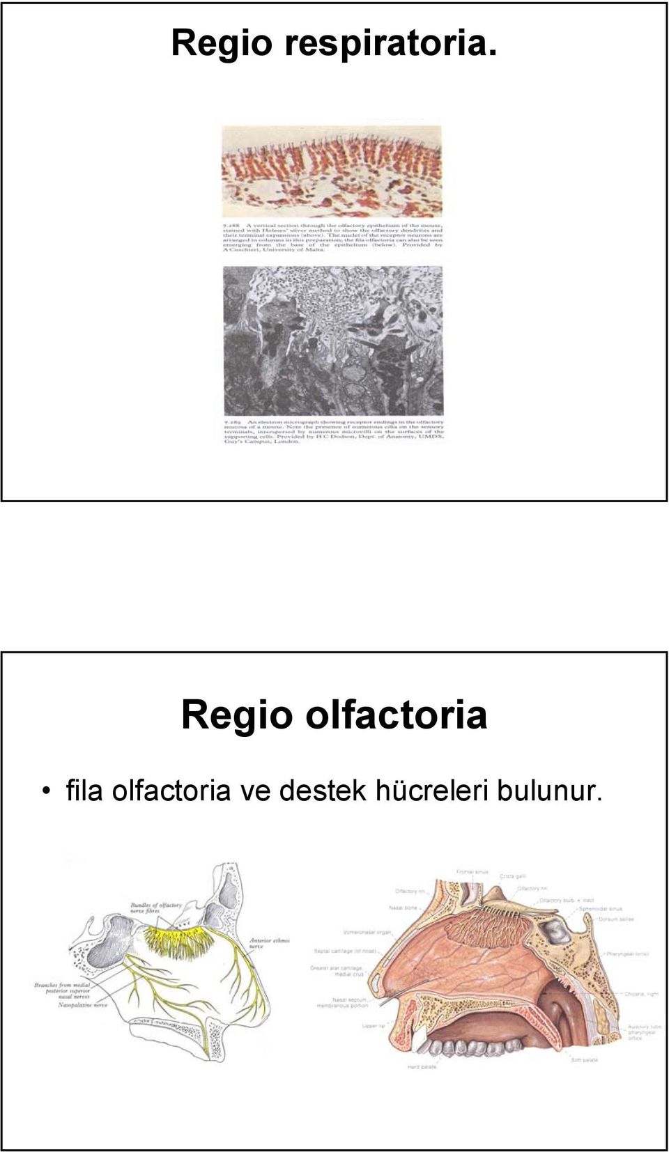 fila olfactoria ve