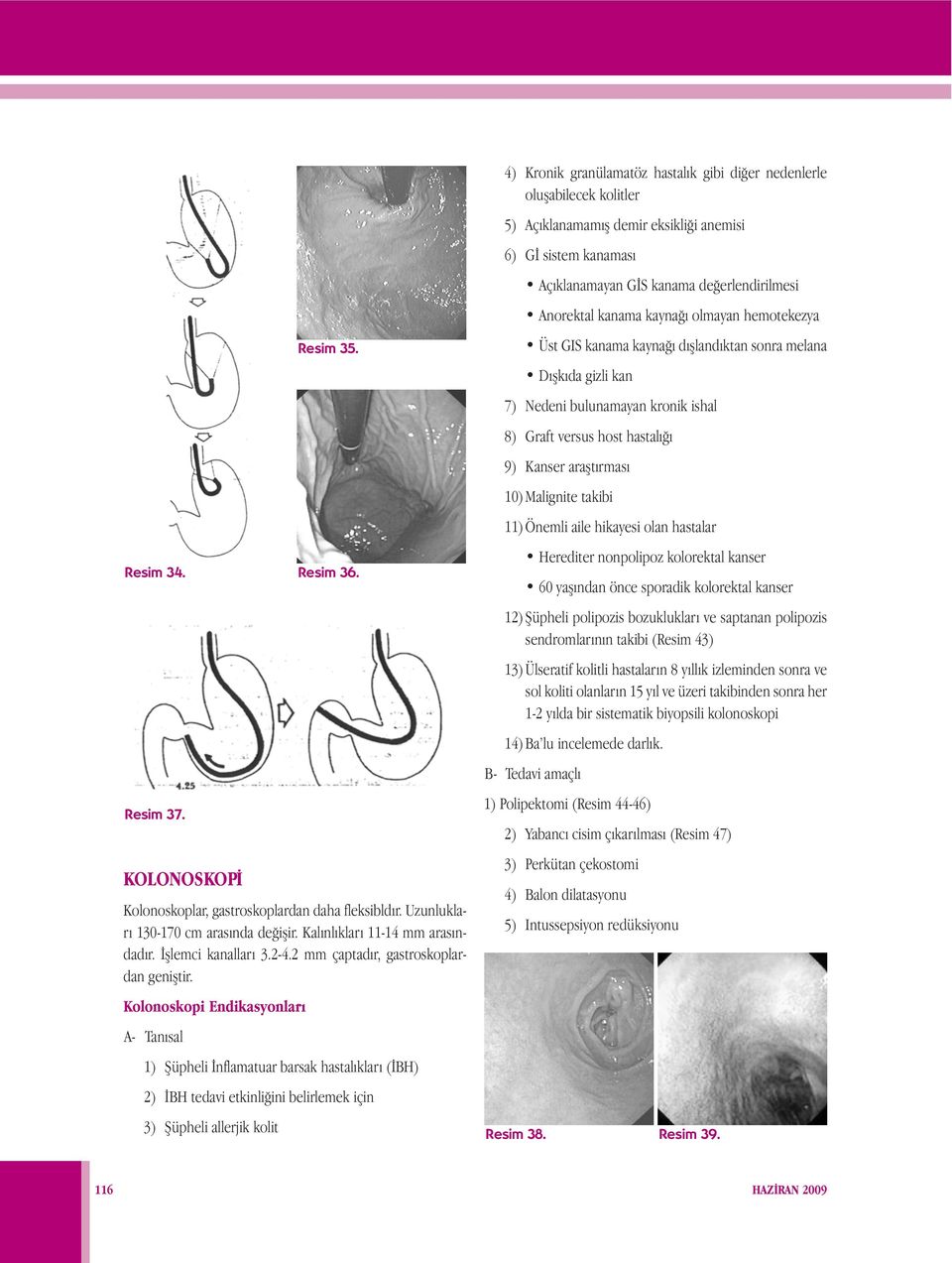 Kolonoskopi Endikasyonları A- Tanısal 1) Şüpheli İnflamatuar barsak hastalıkları (İBH) 2) İBH tedavi etkinliğini belirlemek için 3) Şüpheli allerjik kolit Resim 35. Resim 34. Resim 36. Resim 37.