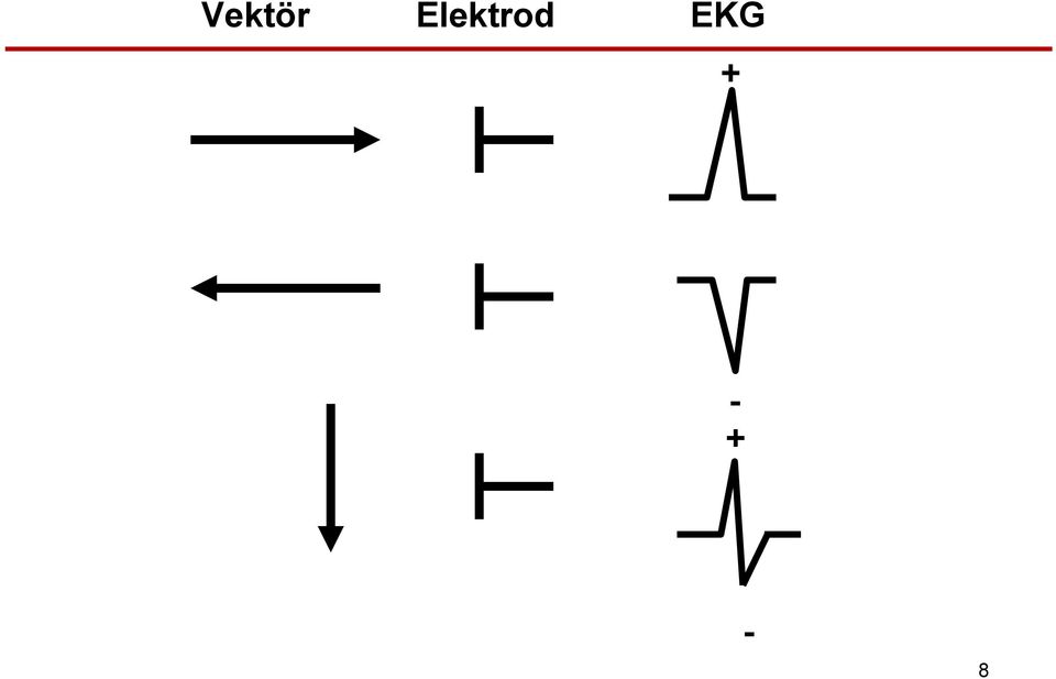 EKG + - +