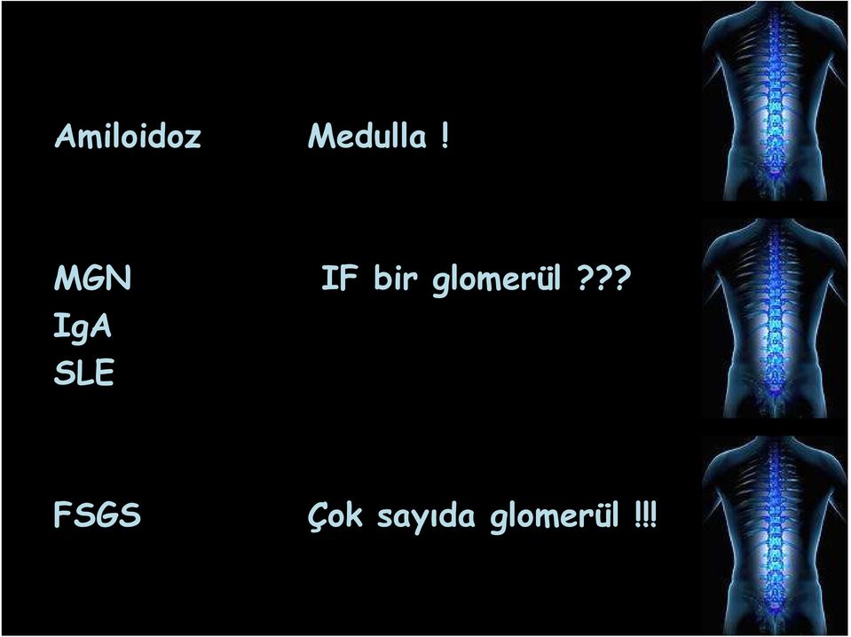 ?? IgA SLE FSGS Çok