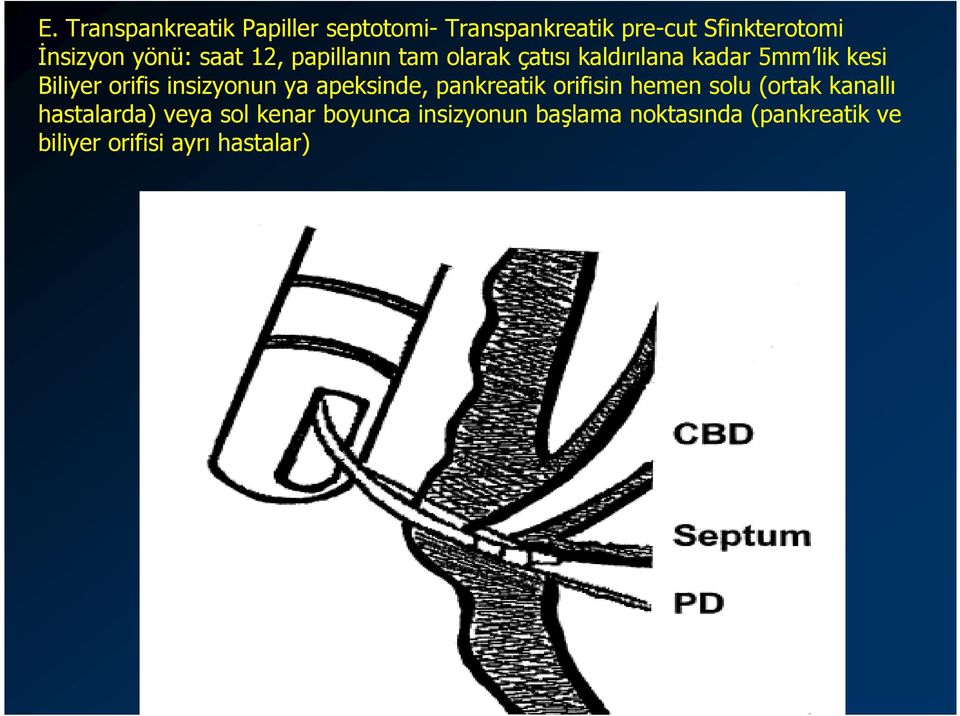 insizyonun ya apeksinde, pankreatik orifisin hemen solu (ortak kanallı hastalarda) veya