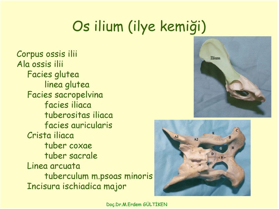 iliaca facies auricularis Crista iliaca tuber coxae tuber sacrale