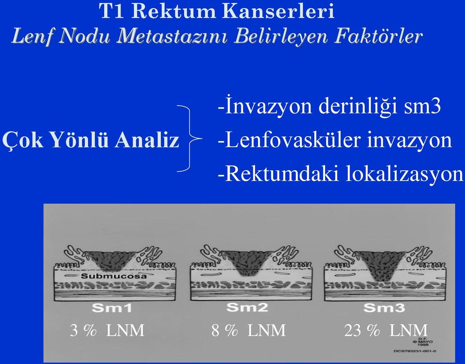 -İnvazyon derinliği sm3 -Lenfovasküler