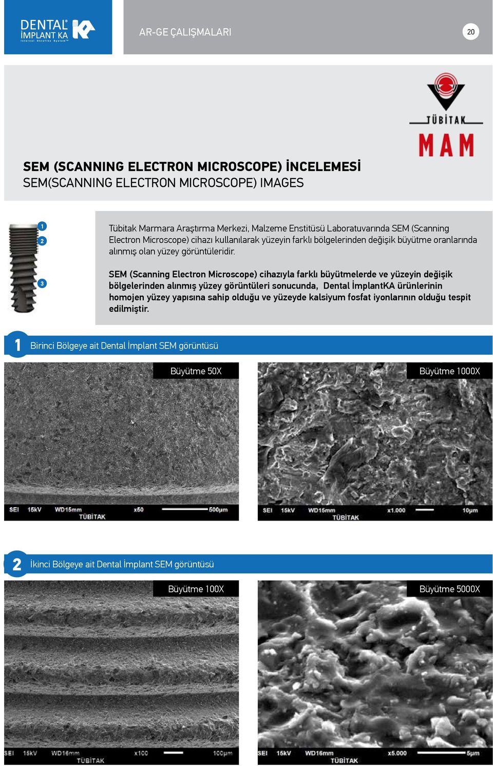 3 SEM (Scanning Electron Microscope) cihazıyla farklı büyütmelerde ve yüzeyin değişik bölgelerinden alınmış yüzey görüntüleri sonucunda, Dental İmplantKA ürünlerinin homojen yüzey