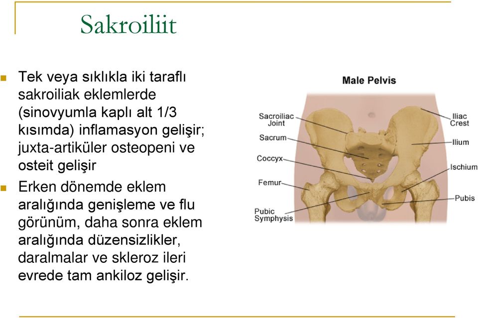 gelişir Erken dönemde eklem aralığında genişleme ve flu görünüm, daha sonra