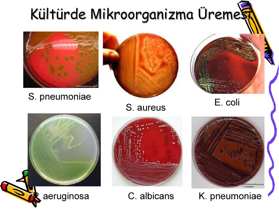 aureus E. coli P.