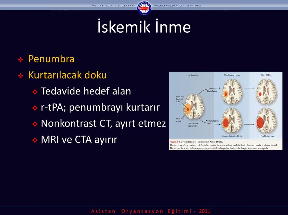 alan r-tpa; penumbrayı kurtarır