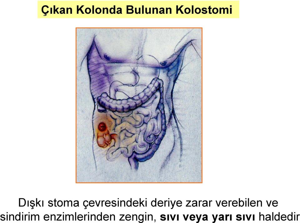 zarar verebilen ve sindirim