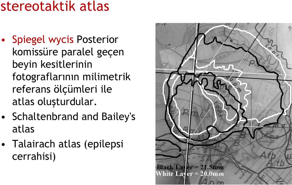 milimetrik referans ölçümleri ile atlas oluşturdular.