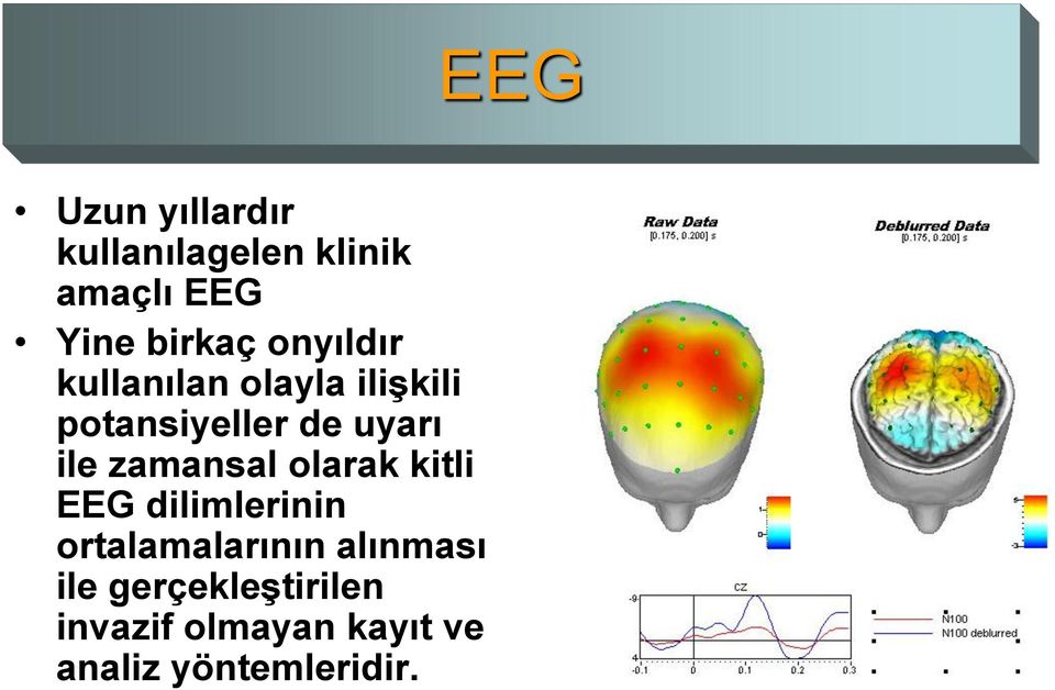 zamansal olarak kitli EEG dilimlerinin ortalamalarının alınması