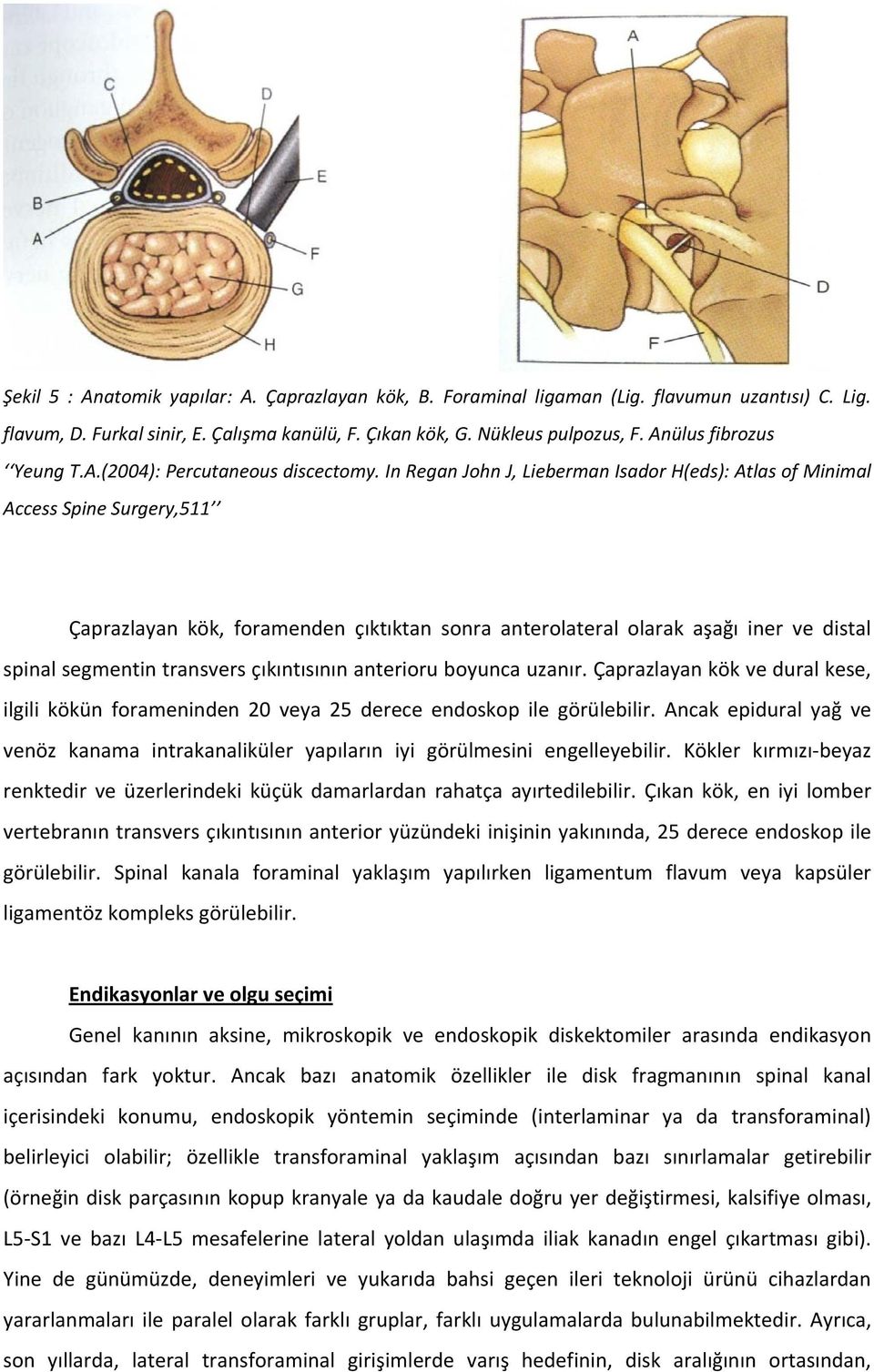 In Regan John J, Lieberman Isador H(eds): Atlas of Minimal Access Spine Surgery,511 Çaprazlayan kök, foramenden çıktıktan sonra anterolateral olarak aşağı iner ve distal spinal segmentin transvers