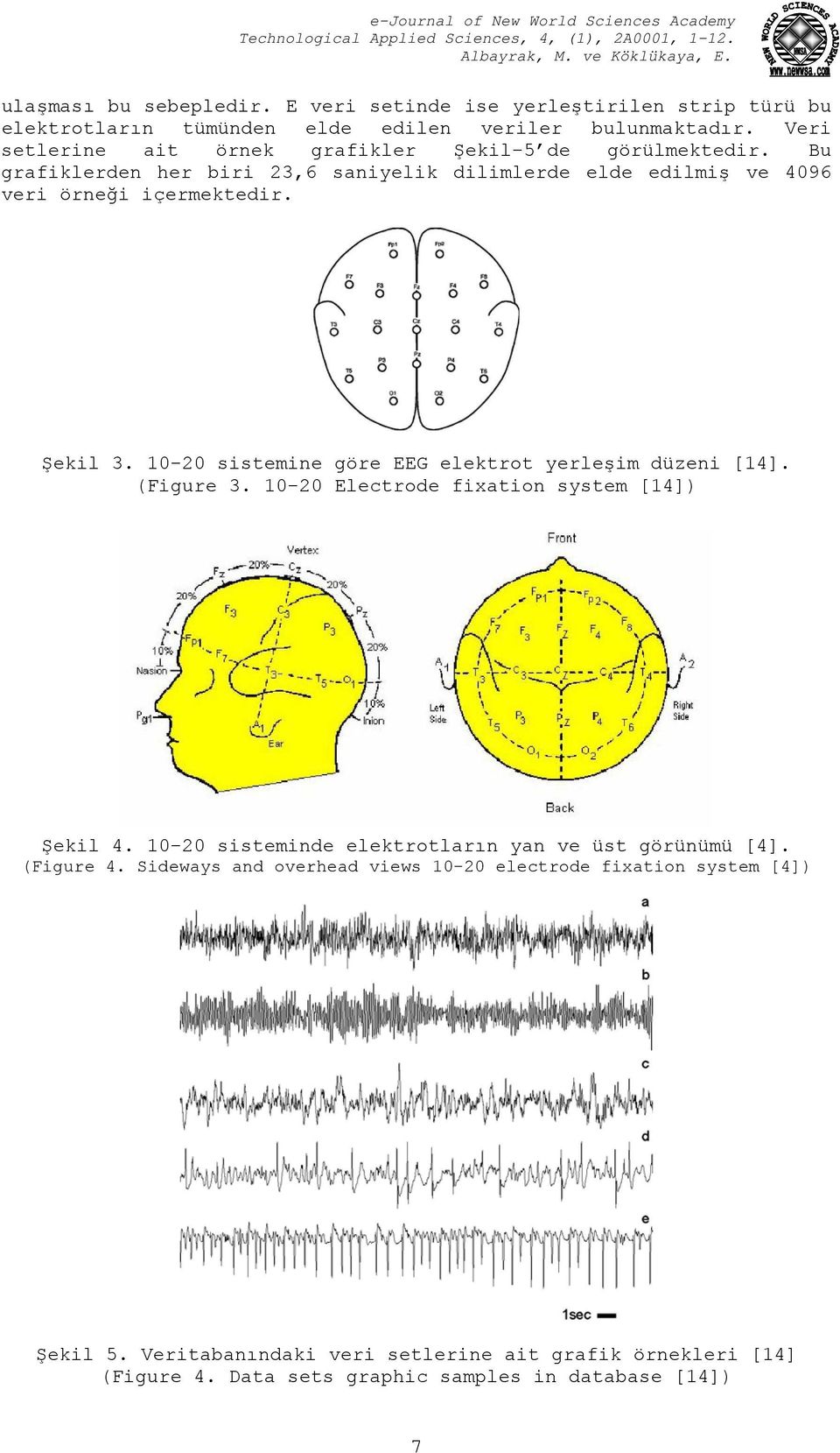10-20 sistemine göre EEG elektrot yerleşim düzeni [14]. (Figure 3. 10-20 Electrode fixation system [14]) Şekil 4.
