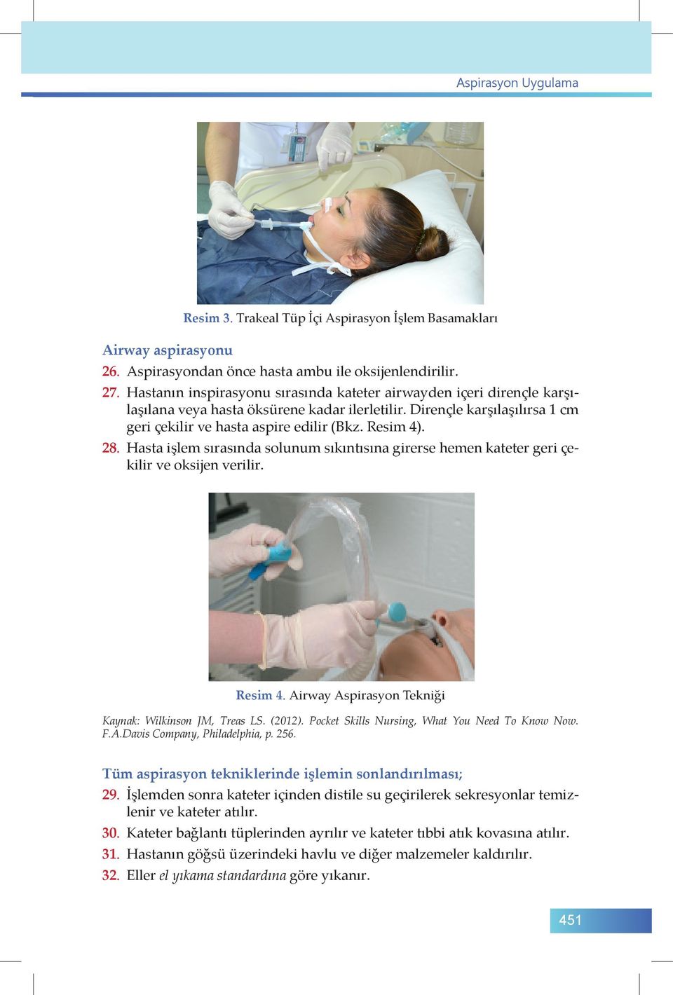 28. Hasta işlem sırasında solunum sıkıntısına girerse hemen kateter geri çekilir ve oksijen verilir. Resim 4. Airway Aspirasyon Tekniği Kaynak: Wilkinson JM, Treas LS. (2012).