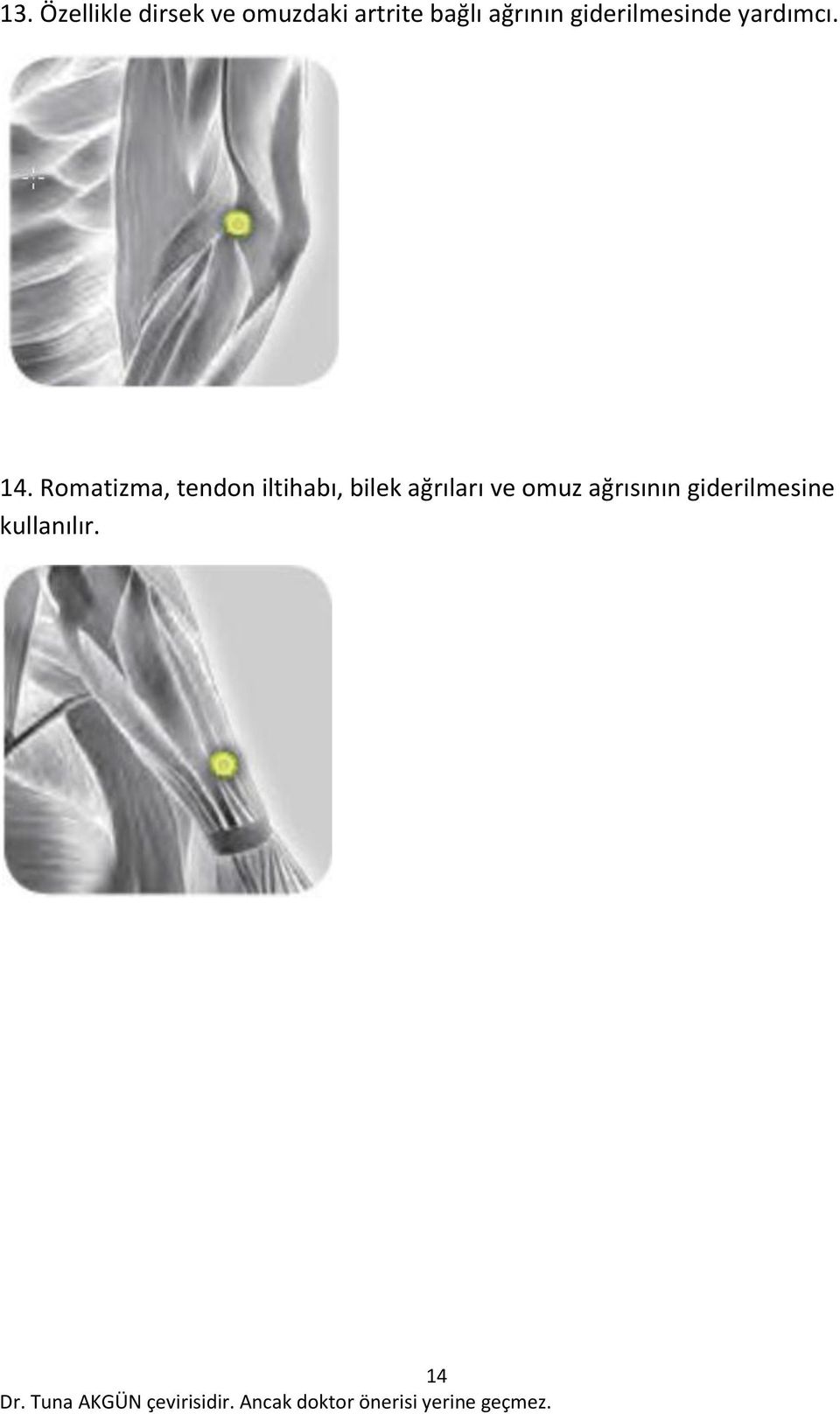 Romatizma, tendon iltihabı, bilek ağrıları