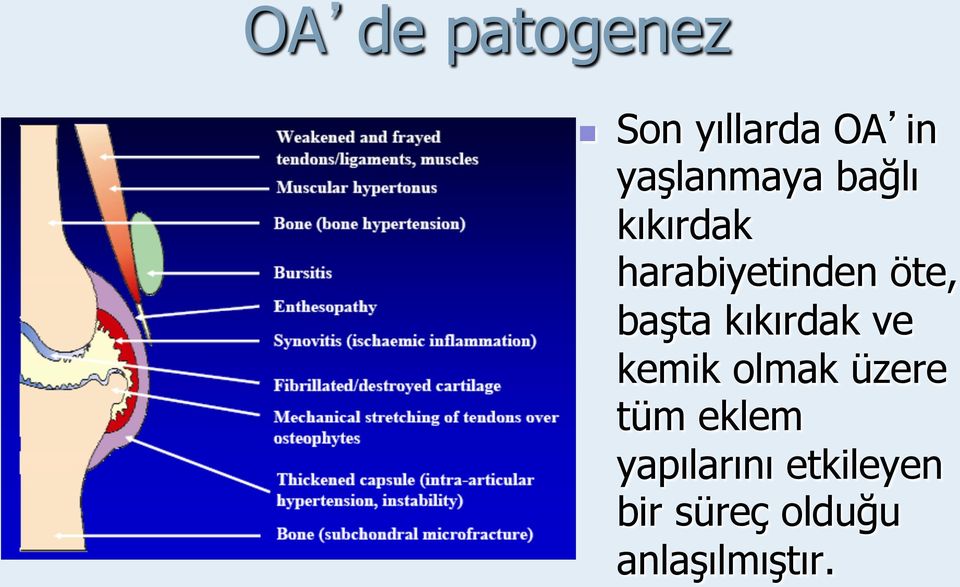 öte, başta kıkırdak ve kemik olmak üzere tüm