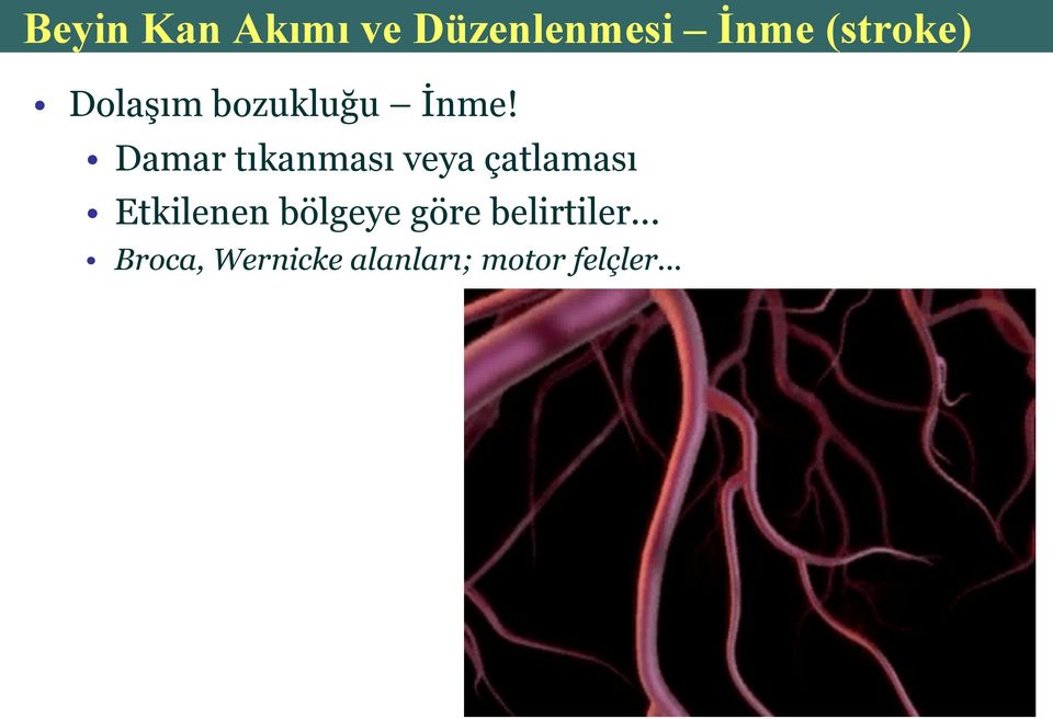 Damar tıkanması veya çatlaması Etkilenen